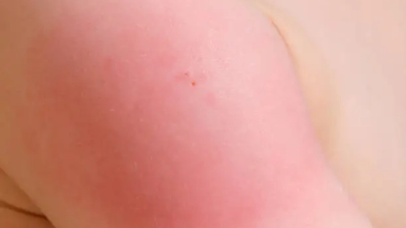 Khi nào cần đi khám bác sĩ